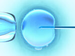 Ovum (In Vitro Fertilization)