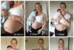 Postpartum body