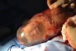 baby born in the sac - en caul birth