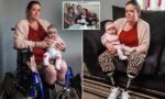 double amputee