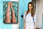 sarah-buller-lymphadema