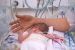 premature-baby-in-nicu