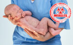 measles-alert-perth