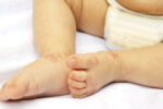 Hand, Foot & Mouth Disease