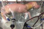 artifical womb