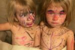Sharpie sisters draw on themselves with permanent markers