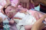 Vanellope Hope Wilkens baby born with heart outside body