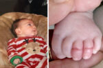 Jacob Fricke hair stuck baby toes