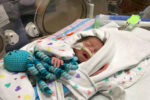 premature baby born 23 weeks