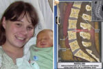epidural needle allegedly left in Amy Bright's spine during childbirth