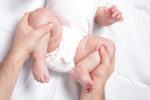 hip dysplasia in babies