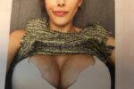 engorged breasts