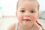 food allergies in children