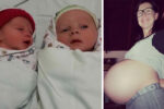 Fiona Hayne died after delivering twins via caesarian
