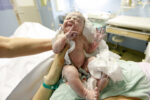 newborn allergies placenta allergy test