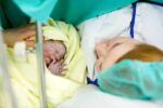 c-section
