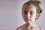 chickenpox child