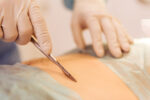 caesarean goes wrong
