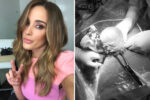 Bec Judd twins birth photos