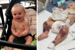 baby lilli meningococcal