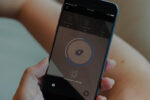 skinvision app