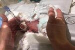World's Tiniest Baby