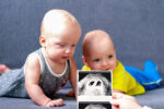 IVF mix-up twins with ultrasound photo