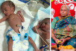 74-year-old woman gives birth twins