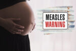 measles outbreak pregnant women babies die