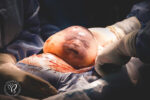 En caul birth