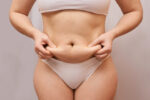 ex-husband liposuction bill