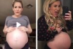 superfetation triplets tiktok