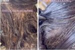 TikTok head lice infestation