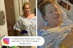amy schumer endometriosis
