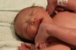 breech baby
