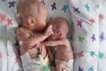 twins reunite in powerful photos