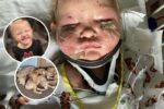 toddler mauled by puppies