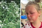 daughter poisoned by common plant