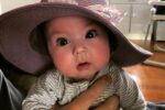 baby Gigi with mosaic trisomy 20 rare disease