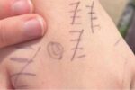 teen's hand - bullying