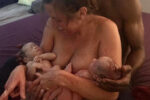 Surprise twins freebirth delivery