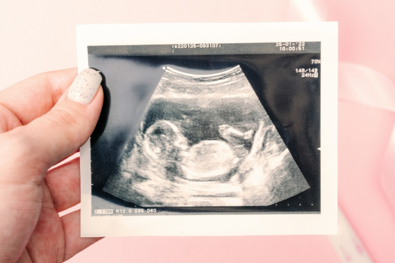 4 Ways to Determine the Gender on Ultrasound Scans - Is it a Boy or Girl?