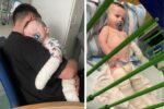 baby burned by bleach at daycare