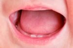natal teeth