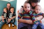Postpartum Psychosis 