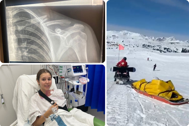 The One Thing You Always Pack But Never Think About (Until You're in a Foreign Hospital) 2 1Cover Travel Insurance Elke broken collar bone xray